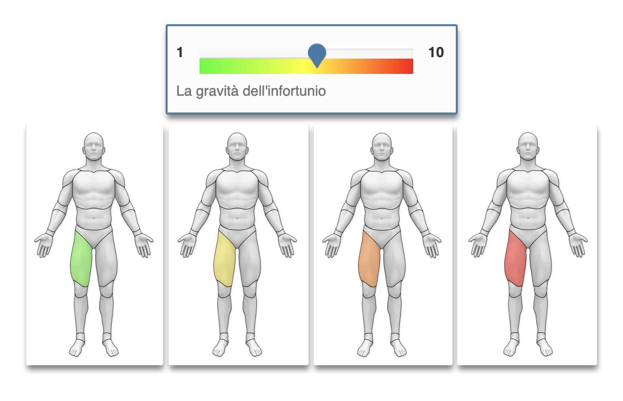 Funzione infortuni - registrare la gravità dell'infortunio