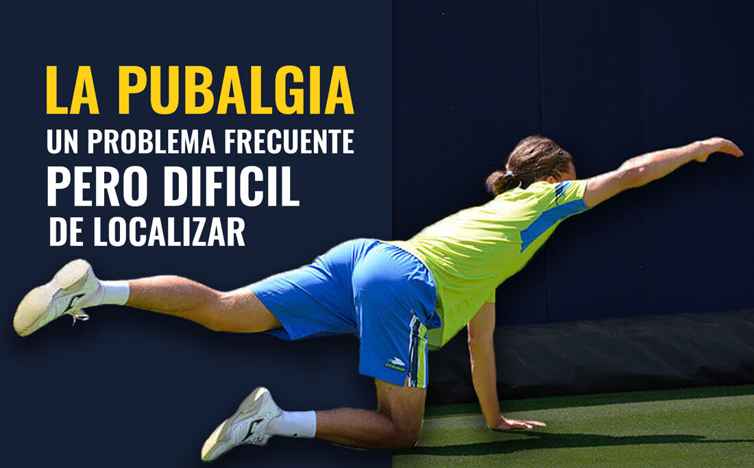 La pubalgia en el deportista